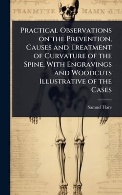 Practical Observations on the Prevention, Causes and Treatment of Curvature of the Spine, With Engravings and Woodcuts Illustrative of the Cases|Samuel Hare