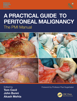 A Practical Guide to Peritoneal Malignancy|Tom Cecil