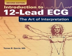 Introduction to 12-Lead Ecg|Tomas B. Garcia