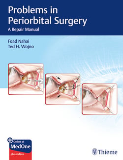 Problems in Periorbital Surgery|Foad Nahai